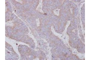 Image no. 1 for anti-SET and MYND Domain Containing 3 (SMYD3) (AA 21-416) antibody (ABIN1501007)
