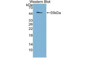 Western Blotting (WB) image for anti-Deiodinase, Iodothyronine, Type III (DIO3) (AA 11-277) antibody (ABIN1858638)