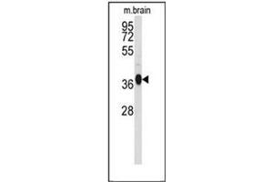 Western blot analysis of GNAO1 Antibody (C-term) Cat. (G Protein alpha 0 (AA 299-328), (C-Term) Antikörper)