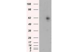 Western Blotting (WB) image for anti-Resistance To Inhibitors of Cholinesterase 8 Homolog A (C. Elegans) (RIC8A) antibody (ABIN1500704) (RIC8A Antikörper)