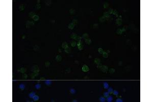 Immunofluorescence analysis of Jurkat cells using CD3D Polyclonal Antibody at dilution of 1:100. (CD3D Antikörper)