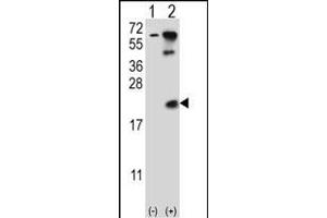 Western blot analysis of UBE2B (arrow) using rabbit polyclonal UBE2B Antibody  (ABIN388848 and ABIN2839152). (UBE2B Antikörper  (C-Term))
