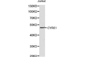 Western blot analysis of Jurkat cell lysate using CYR61 antibody. (CYR61 Antikörper)