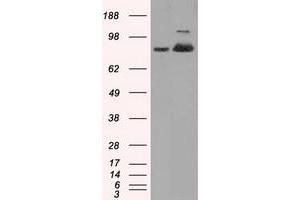 Western Blotting (WB) image for anti-Aconitase 2, Mitochondrial (ACO2) antibody (ABIN1496411) (ACO2 Antikörper)
