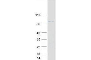 Western Blotting (WB) image for Tripartite Motif Containing 31 (TRIM31) protein (Myc-DYKDDDDK Tag) (ABIN2734247)
