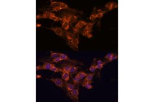 Immunofluorescence analysis of C6 cells using TMED2 antibody (ABIN7270943) at dilution of 1:100.