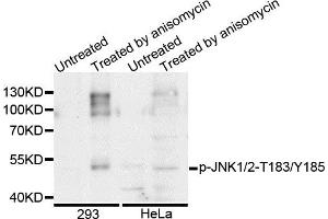 Western blot analysis of extracts of various cell lines, using Phospho-JNK1/2-T183/Y185 antibody. (JNK1/2 Antikörper  (pThr183, pTyr185))