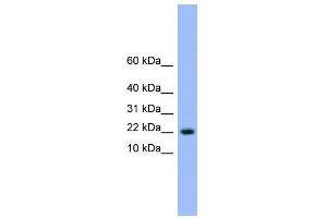 WB Suggested Anti-NXT1 Antibody Titration: 0. (NXT1 Antikörper  (N-Term))