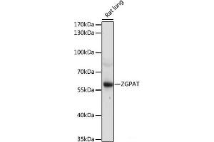 Western blot analysis of extracts of Rat lung using ZGPAT Polyclonal Antibody at dilution of 1:1000. (ZGPAT Antikörper)