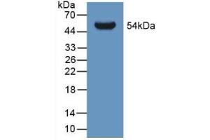 Detection of Recombinant GLTP, Human using Polyclonal Antibody to Glycolipid Transfer Protein (GLTP) (GLTP Antikörper  (AA 2-209))