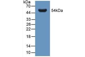 Detection of Recombinant GLTP, Human using Polyclonal Antibody to Glycolipid Transfer Protein (GLTP)
