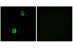 Immunofluorescence analysis of MCF-7 cells, using CST1 antibody. (CST1 Antikörper  (Internal Region))