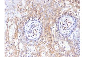 Formalin-fixed, paraffin-embedded human Tongue stained with CD59 Mouse Monoclonal Antibody (MACIF/629). (CD59 Antikörper)