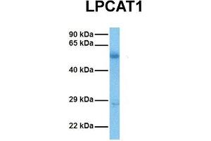 Host:  Rabbit  Target Name:  LPCAT1  Sample Tissue:  Human Ovary Tumor  Antibody Dilution:  1. (LPCAT1 Antikörper  (Middle Region))