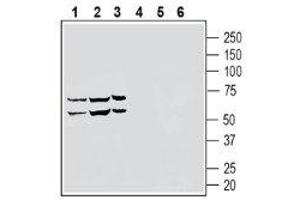 Western blot analysis of human  monocytic leukemia cell line lysate (lanes 1 and 4), human  natural killer cell line lysate (lanes 2 and 5) and human  promyelocytic leukemia cell line lysate (lanes 3 and 6) lysates: 1-3. (Sphingosine-1-Phosphate Receptor 5 (S1PR5) Peptid)
