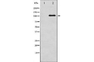 Western blot analysis of NMDAR1 phosphorylation expression in A549 whole cell lysates,The lane on the left is treated with the antigen-specific peptide. (GRIN1/NMDAR1 Antikörper  (pSer890))