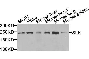 Western blot analysis of extracts of various cells, using SLK antibody. (SLK Antikörper)
