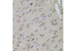 Immunohistochemistry of paraffin-embedded rat brain using SUMO3 antibody (ABIN5971585) (40x lens). (SUMO3 Antikörper)