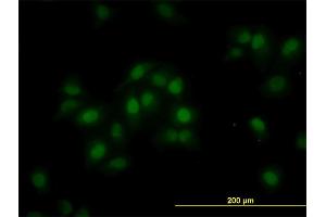 Immunofluorescence of purified MaxPab antibody to ORC6L on HeLa cell.