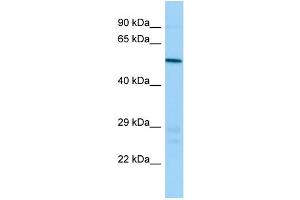 Western Blotting (WB) image for anti-ATPase, H+ Transporting, Lysosomal 56/58kDa, V1 Subunit B1 (ATP6V1B1) (N-Term) antibody (ABIN2786640)