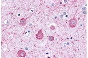 Anti-LPHN2 antibody  ABIN1049026 IHC staining of human brain, neurons and glia. (LPHN2 Antikörper  (C-Term))
