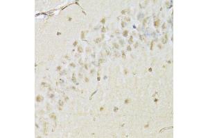 Immunohistochemistry (Paraffin-embedded Sections) (IHC (p)) image for anti-Histone Deacetylase 3 (HDAC3) (AA 299-428) antibody (ABIN3023018)