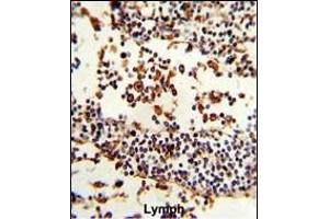 Formalin-fixed and paraffin-embedded human Lymph reacted with IGHA1 Antibody (C-term), which was peroxidase-conjugated to the secondary antibody, followed by DAB staining. (IGHA1 Antikörper  (C-Term))