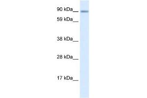 Human Lung; WB Suggested Anti-ZNF537 Antibody Titration: 0. (TSHZ3 Antikörper  (Middle Region))