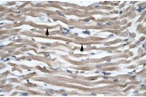 Immunohistochemical staining (Formalin-fixed paraffin-embedded sections) of human muscle with DLX2 polyclonal antibody  at 4-8 ug/mL working concentration. (DLX2 Antikörper  (N-Term))