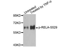 Western blot analysis of extracts from 293 cells, using Phospho-RELA-S529 antibody (ABIN2987626). (NF-kB p65 Antikörper  (pSer529))