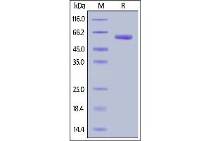 Human VSIG3, Fc Tag on  under reducing (R) condition. (IGSF11 Protein (AA 23-241) (Fc Tag))