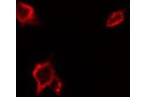 ABIN6277587 staining Hela by IF/ICC. (MERTK Antikörper  (Internal Region))