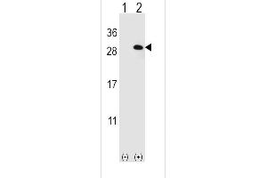 Western blot analysis of EIF4E2 using rabbit polyclonal EIF4E2 Antibody using 293 cell lysates (2 ug/lane) either nontransfected (Lane 1) or transiently transfected (Lane 2) with the EIF4E2 gene. (EIF4E2 Antikörper)