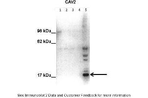 Lanes:   Lane1: 50 ug human placental tissue lysate Lane2: 40 ug human placental tissue lysate Lane3: 30 ug human placental tissue lysate Lane4: 20 ug human placental tissue lysate Lane5: 20 ug human myometrial tissue lysate  Primary Antibody Dilution:   1:500  Secondary Antibody:   Goat anti-rabbit HRP  Secondary Antibody Dilution:   1:10000  Gene Name:   Caveolin 2  Submitted by:   Hiten Mistry, Ania Czajka and Marta Hentschke Ribeiro, King's College London (Caveolin 2 Antikörper  (N-Term))