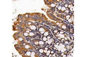 Immunohistochemistry of paraffin embedded mouse colon using RAB21 (ABIN7075341) at dilution of 1: 700 (400x lens) (RAB21 Antikörper)