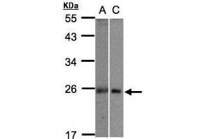 WB Image Sample(30 ug whole cell lysate) A:293T B:Hep G2 , 12% SDS PAGE antibody diluted at 1:1000 (m1ip1 Antikörper)
