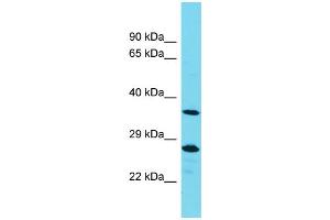 Western Blotting (WB) image for anti-Protein Tyrosine Phosphatase, Non-Receptor Type 20A (PTPN20A) (Middle Region) antibody (ABIN2791465) (PTPN20A Antikörper  (Middle Region))