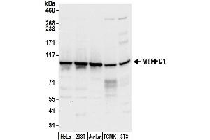 Western Blotting (WB) image for anti-Methylenetetrahydrofolate Dehydrogenase (NADP+ Dependent) 1, Methenyltetrahydrofolate Cyclohydrolase, Formyltetrahydrofolate Synthetase (MTHFD1) (AA 150-200) antibody (ABIN7450465)