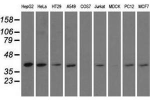 Western blot analysis of extracts (35 µg) from 9 different cell lines by using anti-HIBCH monoclonal antibody. (HIBCH Antikörper)
