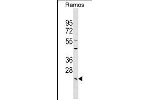 Western blot analysis in Ramos cell line lysates (35ug/lane). (LYPLA2 Antikörper  (C-Term))