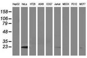 Image no. 2 for anti-Lin-7 Homolog B (LIN7B) antibody (ABIN1499156) (LIN7B Antikörper)