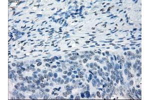 Immunohistochemical staining of paraffin-embedded colon tissue using anti-NAT8mouse monoclonal antibody. (NAT8 Antikörper)