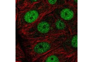 Immunofluorescent staining of MCF7 cells with MCM7 polyclonal antibody  (Green) shows positivity in nucleus but excluded from the nucleoli. (MCM7 Antikörper)