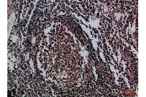 Immunohistochemical analysis of paraffin-embedded Human-tonsil, antibody was diluted at 1:100 (IL17D Antikörper  (AA 141-190))