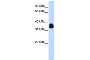 Image no. 1 for anti-AIMP1 / EMAP II (AA 108-157) antibody (ABIN6742988) (AIMP1 / EMAP II (AA 108-157) Antikörper)