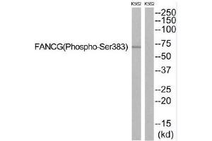 Western blot analysis of extracts from K562 cells, using FANCG (Phospho-Ser383) antibody. (FANCG Antikörper  (pSer383))