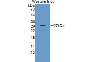 Western blot analysis of the recombinant protein. (Recoverin Antikörper  (AA 2-200))