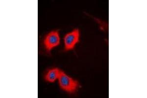 Immunofluorescent analysis of PKC theta staining in HeLa cells. (PKC theta Antikörper  (C-Term))