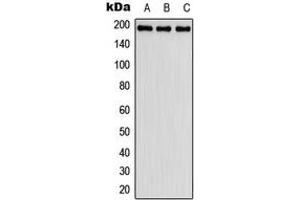 Western blot analysis of Fibulin 2 expression in HeLa (A), SP2/0 (B), H9C2 (C) whole cell lysates. (FBLN2 Antikörper  (Center))