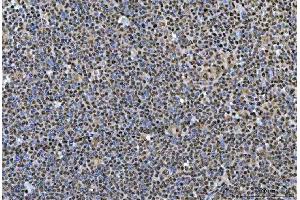 IHC analysis of SNRPN using anti-SNRPN antibody (ABIN3043934). (SNRPN Antikörper  (N-Term))